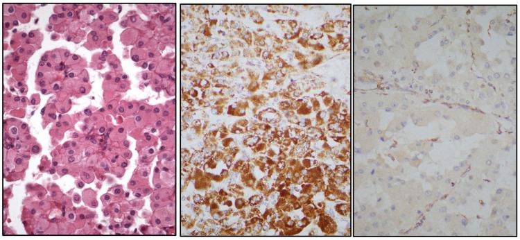https://cdn.ncbi.nlm.nih.gov/pmc/blobs/f15e/11987958/98987f5281e2/cancers-17-01173-g008.jpg