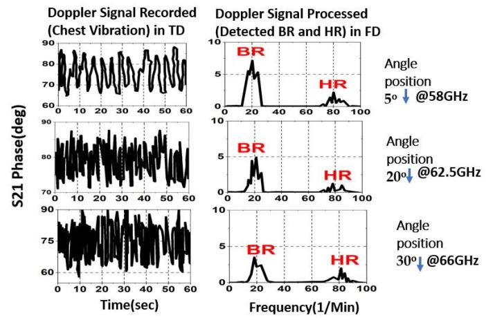 https://cdn.ncbi.nlm.nih.gov/pmc/blobs/f166/10146583/679216f5f71e/sensors-23-04059-g016.jpg