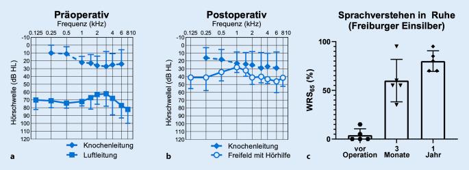 https://cdn.ncbi.nlm.nih.gov/pmc/blobs/f166/10234956/09d82c7850fe/106_2022_1189_Fig6_HTML.jpg