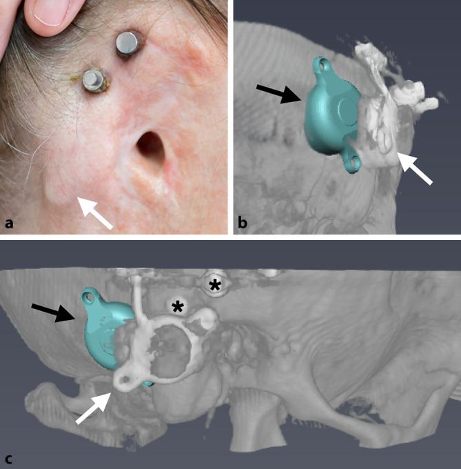 https://cdn.ncbi.nlm.nih.gov/pmc/blobs/f166/10234956/c4cbe53d60ea/106_2022_1189_Fig5_HTML.jpg