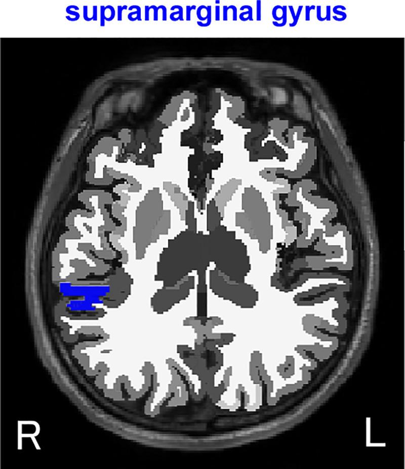 https://cdn.ncbi.nlm.nih.gov/pmc/blobs/f171/8297759/67cf61c3f252/pone.0254623.g003.jpg