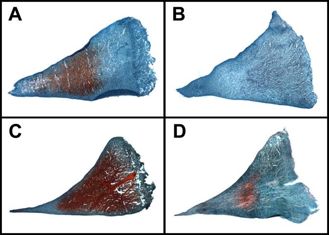 https://cdn.ncbi.nlm.nih.gov/pmc/blobs/f17e/5415046/3b94dc2c2ebe/10.1177_2325967117702452-fig7.jpg