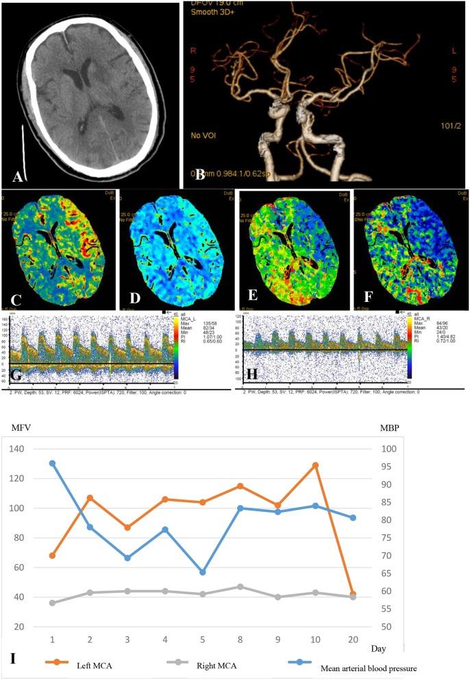 https://cdn.ncbi.nlm.nih.gov/pmc/blobs/f17e/6618680/eb175661c999/fneur-10-00719-g0001.jpg