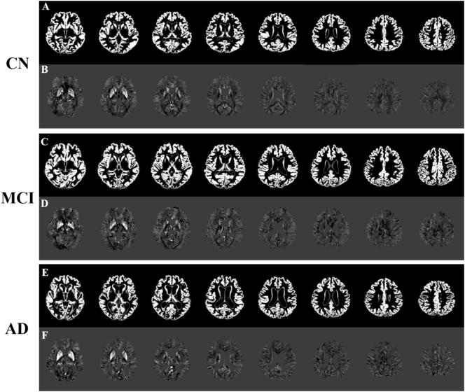 https://cdn.ncbi.nlm.nih.gov/pmc/blobs/f183/5577408/43c3e2c60100/gr1.jpg