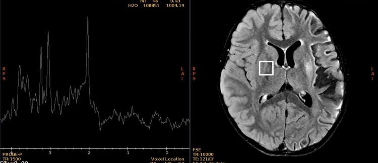 https://cdn.ncbi.nlm.nih.gov/pmc/blobs/f18b/10560088/38aed2119c46/cureus-0015-00000046647-i09.jpg