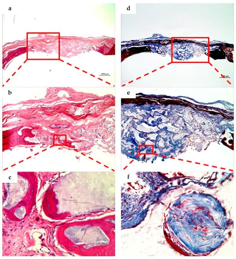 https://cdn.ncbi.nlm.nih.gov/pmc/blobs/f18b/5506921/5556b3c8e92d/materials-10-00421-g007.jpg