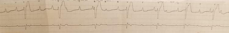 https://cdn.ncbi.nlm.nih.gov/pmc/blobs/f193/10181950/d5c2472ab093/cureus-0015-00000037507-i04.jpg
