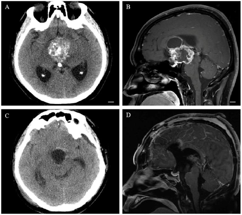 https://cdn.ncbi.nlm.nih.gov/pmc/blobs/f195/9856947/0a3c56f8f5a0/cancers-15-00340-g002.jpg