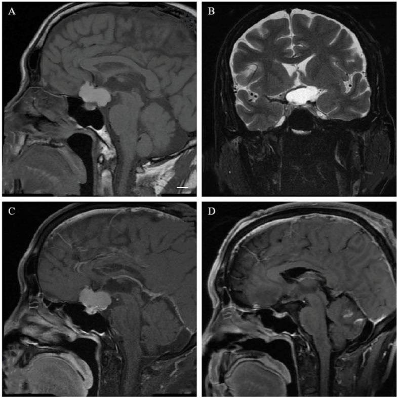 https://cdn.ncbi.nlm.nih.gov/pmc/blobs/f195/9856947/33d3413fb219/cancers-15-00340-g003.jpg