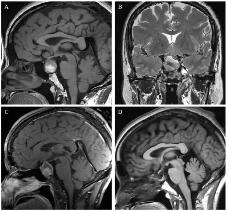 https://cdn.ncbi.nlm.nih.gov/pmc/blobs/f195/9856947/92ceb16b784c/cancers-15-00340-g004.jpg