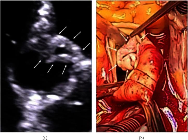 https://cdn.ncbi.nlm.nih.gov/pmc/blobs/f198/11527529/e25f13c44b9d/CRIID2024-1093820.003.jpg