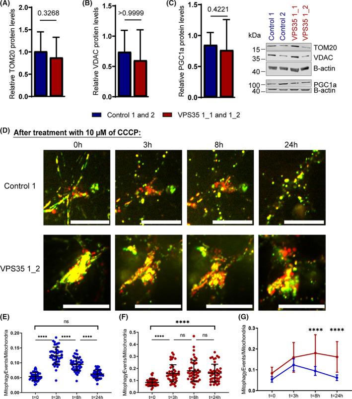 https://cdn.ncbi.nlm.nih.gov/pmc/blobs/f19a/8048506/24de34ea6495/MDS-36-704-g001.jpg