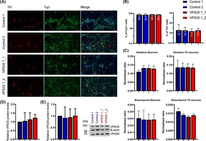 https://cdn.ncbi.nlm.nih.gov/pmc/blobs/f19a/8048506/48a9f2271e65/MDS-36-704-g005.jpg