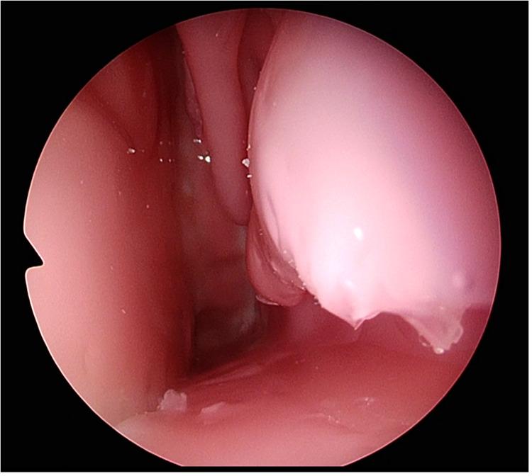https://cdn.ncbi.nlm.nih.gov/pmc/blobs/f19c/9764859/da7a36e505e7/fsurg-09-1049685-g003.jpg