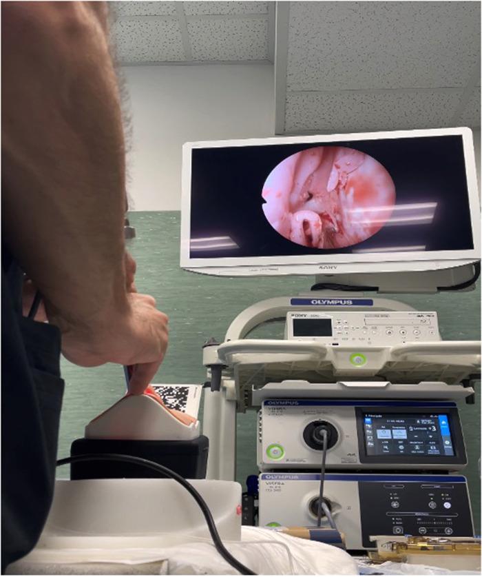 https://cdn.ncbi.nlm.nih.gov/pmc/blobs/f19c/9764859/e952c63694bf/fsurg-09-1049685-g002.jpg