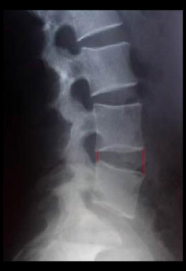 https://cdn.ncbi.nlm.nih.gov/pmc/blobs/f19e/4762298/5b5621e7ace1/medscimonit-22-530-g003.jpg