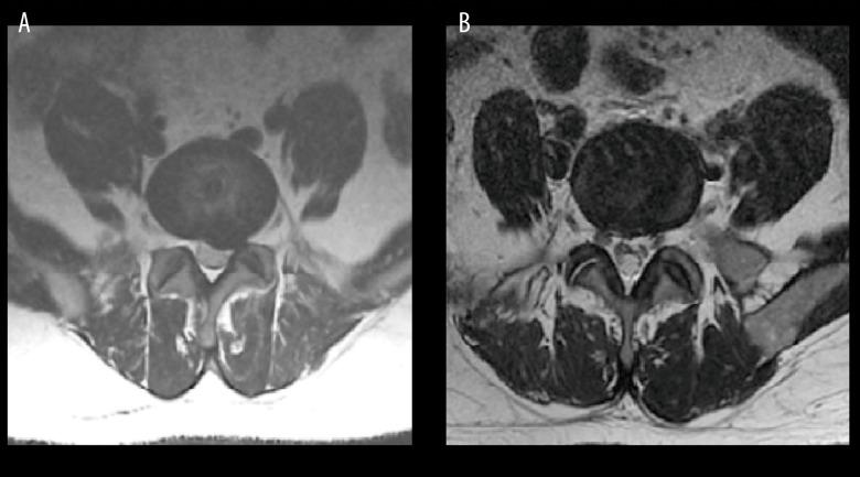 https://cdn.ncbi.nlm.nih.gov/pmc/blobs/f19e/4762298/cc31ba26649f/medscimonit-22-530-g004.jpg