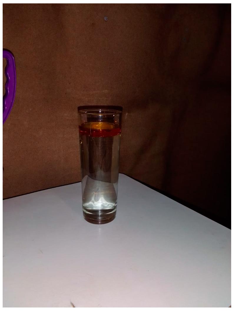https://cdn.ncbi.nlm.nih.gov/pmc/blobs/f1a0/12115927/22a5b054acf3/tropicalmed-10-00126-g002.jpg