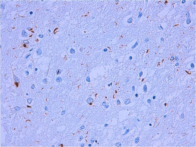 https://cdn.ncbi.nlm.nih.gov/pmc/blobs/f1a6/5464560/ec76ce700e7b/pone.0178093.g001.jpg
