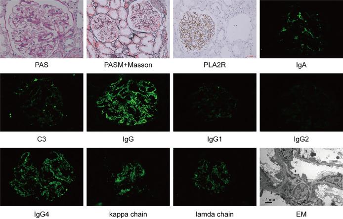 https://cdn.ncbi.nlm.nih.gov/pmc/blobs/f1b1/8961684/d0f1926377cc/fimmu-13-846323-g001.jpg