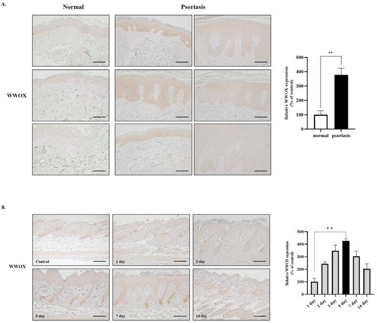 https://cdn.ncbi.nlm.nih.gov/pmc/blobs/f1b8/10779412/342b4ce8c21b/ijms-25-00167-g001.jpg