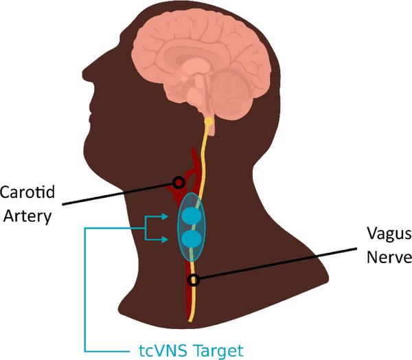https://cdn.ncbi.nlm.nih.gov/pmc/blobs/f1b9/8580056/6bf92e02ab87/nihms-1735470-f0003.jpg