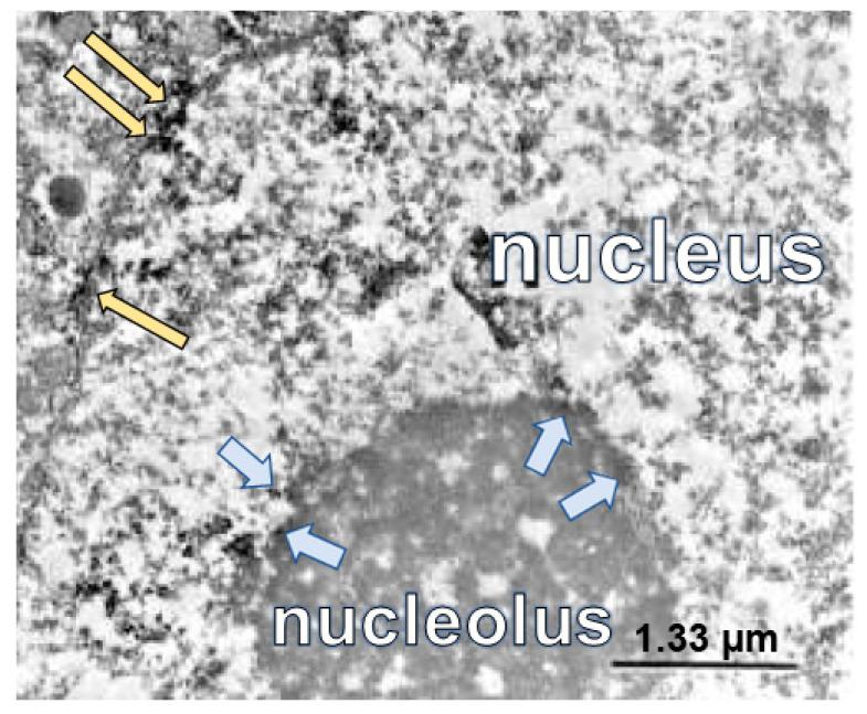 https://cdn.ncbi.nlm.nih.gov/pmc/blobs/f1bb/10488196/361deee581c1/ijms-24-13196-g002.jpg