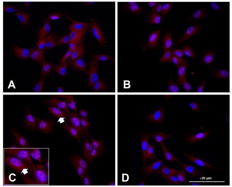 https://cdn.ncbi.nlm.nih.gov/pmc/blobs/f1bb/10488196/9ac2cdb2efd8/ijms-24-13196-g003.jpg