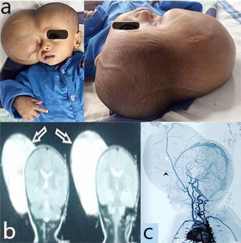 https://cdn.ncbi.nlm.nih.gov/pmc/blobs/f1be/11654665/702484d1698a/PJMS-40-S90-g001.jpg