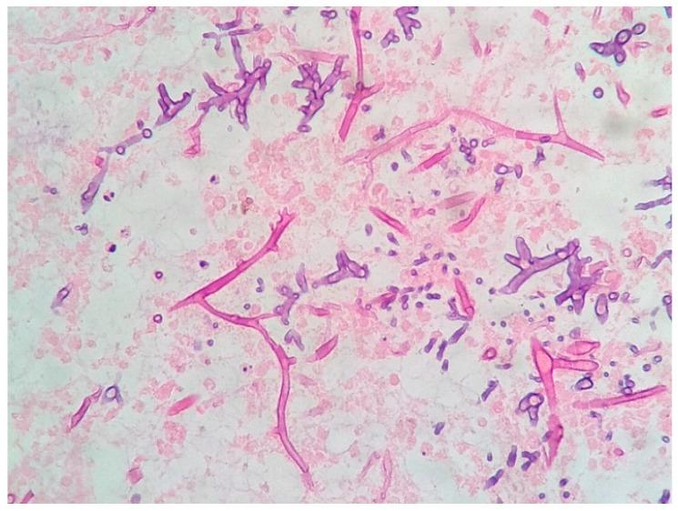 https://cdn.ncbi.nlm.nih.gov/pmc/blobs/f1c1/10801611/37eaf5b96240/geriatrics-09-00004-g003.jpg