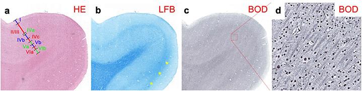 https://cdn.ncbi.nlm.nih.gov/pmc/blobs/f1c6/9832921/4eaade5fb64c/nihms-1860484-f0003.jpg