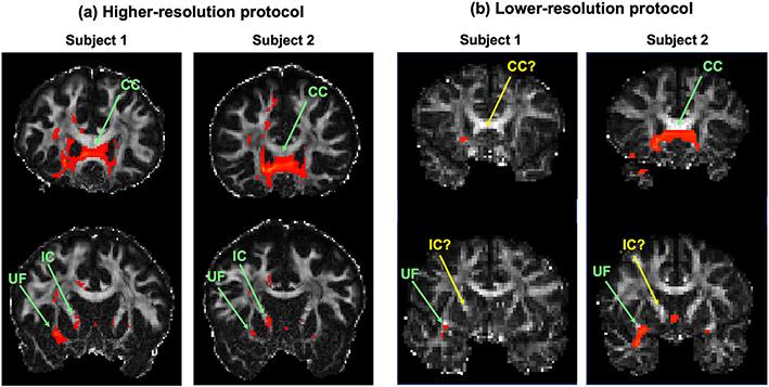 https://cdn.ncbi.nlm.nih.gov/pmc/blobs/f1c6/9832921/e42c97599095/nihms-1860484-f0002.jpg