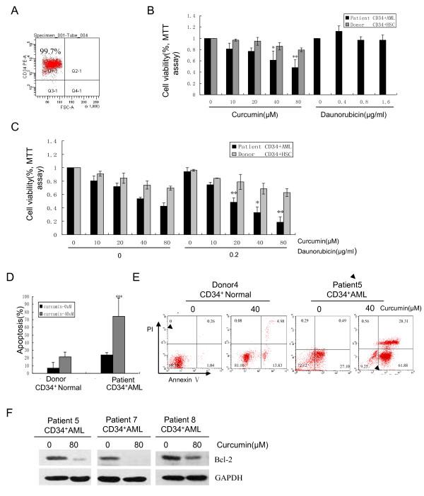 https://cdn.ncbi.nlm.nih.gov/pmc/blobs/f1ca/3118333/615b2654e51b/1479-5876-9-71-7.jpg