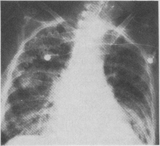 https://cdn.ncbi.nlm.nih.gov/pmc/blobs/f1ce/1704481/660e795c5685/canmedaj01455-0074-a.jpg