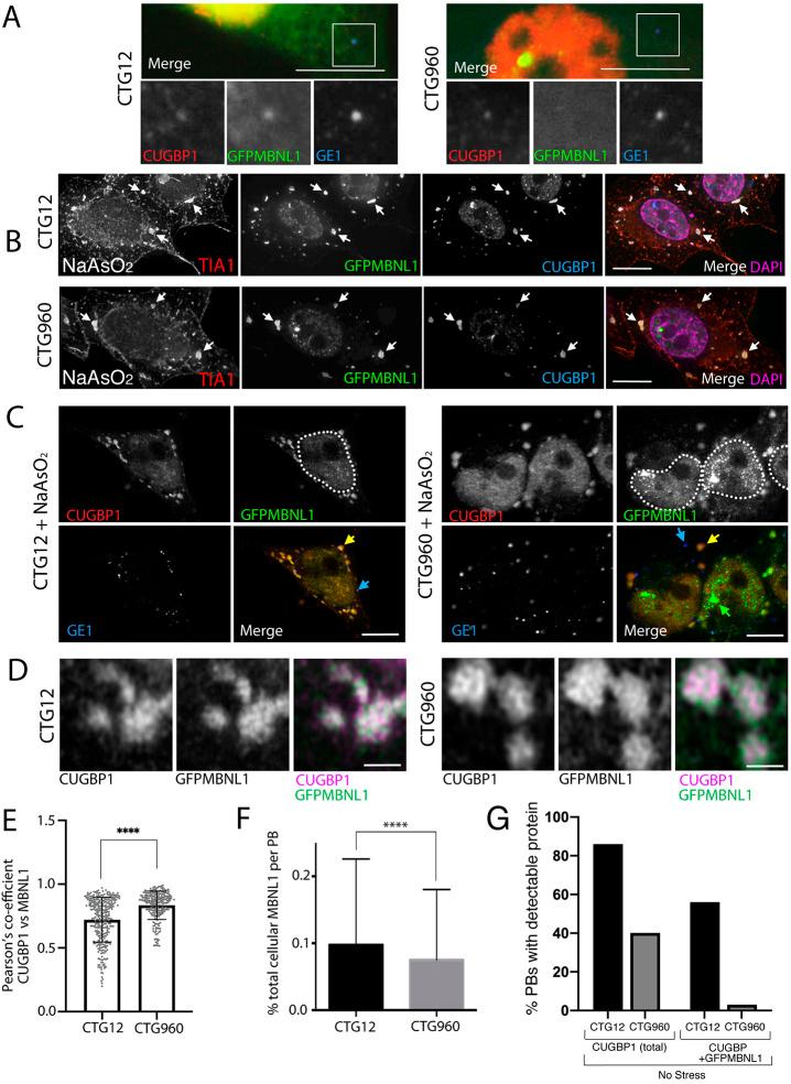 https://cdn.ncbi.nlm.nih.gov/pmc/blobs/f1d2/9366894/0d613d70b873/dmm-15-049294-g4.jpg