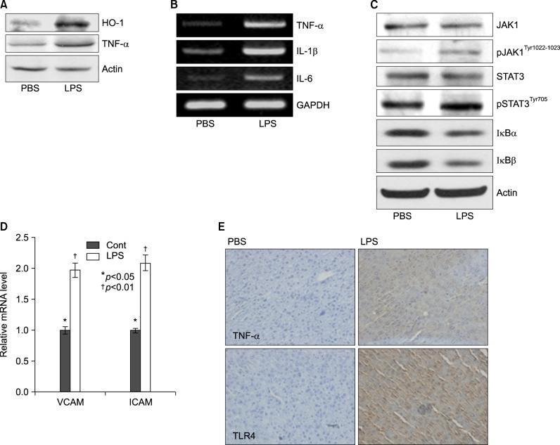 https://cdn.ncbi.nlm.nih.gov/pmc/blobs/f1d3/4304524/ec029d6d2002/kjhbps-17-89-g004.jpg