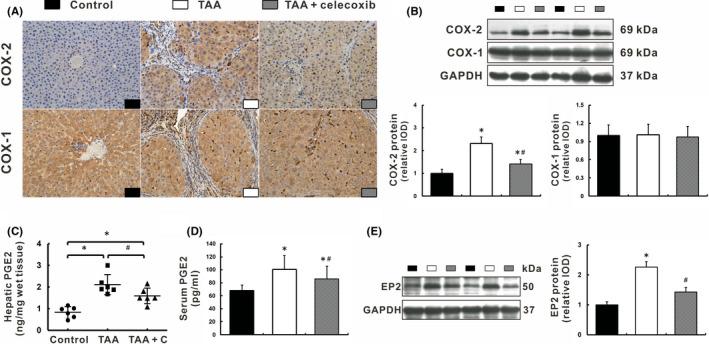 https://cdn.ncbi.nlm.nih.gov/pmc/blobs/f1e2/8581330/e33f3a2e213c/JCMM-25-10389-g004.jpg