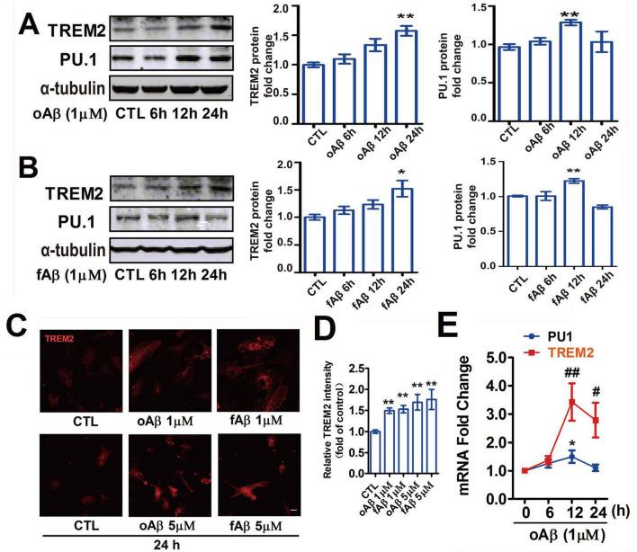 https://cdn.ncbi.nlm.nih.gov/pmc/blobs/f1e5/12078285/4f530e7357e5/fnagi-17-1537388-g004.jpg