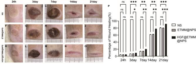 https://cdn.ncbi.nlm.nih.gov/pmc/blobs/f1eb/11754751/72c12910b7f4/41598_2025_86716_Fig7_HTML.jpg