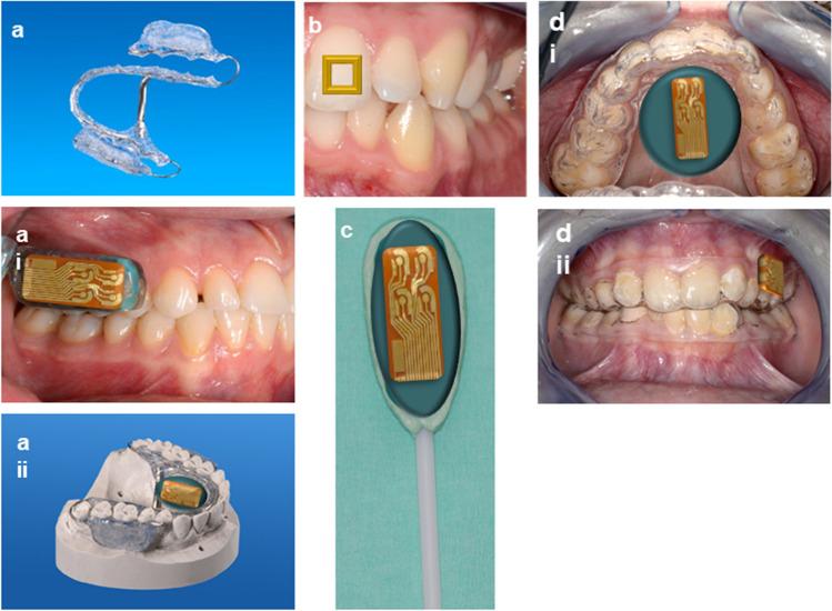 https://cdn.ncbi.nlm.nih.gov/pmc/blobs/f1ec/10560166/2d1507815dc8/784_2023_5206_Fig3_HTML.jpg