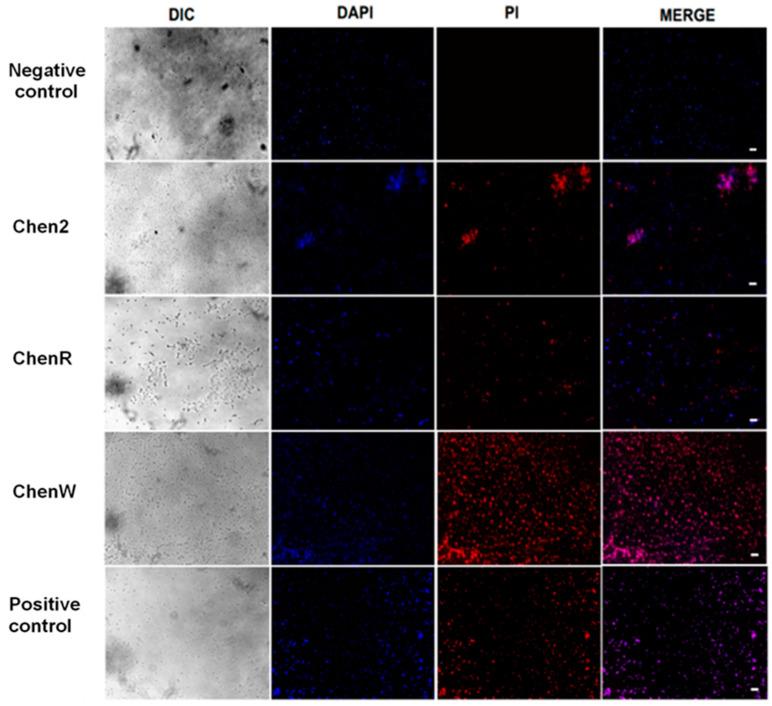 https://cdn.ncbi.nlm.nih.gov/pmc/blobs/f1f2/10812719/51453e9f560d/antibiotics-13-00078-g004.jpg
