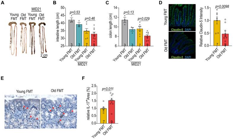 https://cdn.ncbi.nlm.nih.gov/pmc/blobs/f1fb/12339018/8ee4041f8da5/aging-17-206279-g002.jpg
