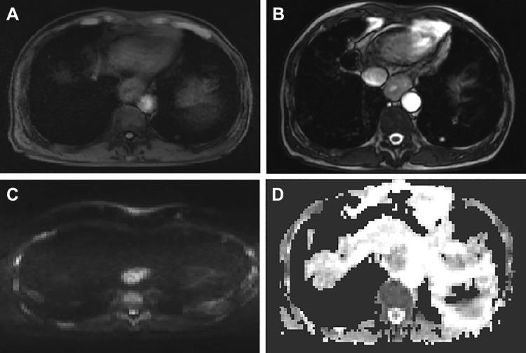 https://cdn.ncbi.nlm.nih.gov/pmc/blobs/f200/6886268/76f46c7e5655/10.1177_1533033819892254-fig2.jpg