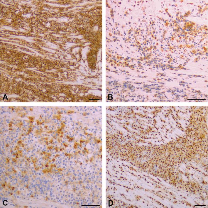https://cdn.ncbi.nlm.nih.gov/pmc/blobs/f209/11787998/e98abeabf55a/NEUP-45-76-g003.jpg