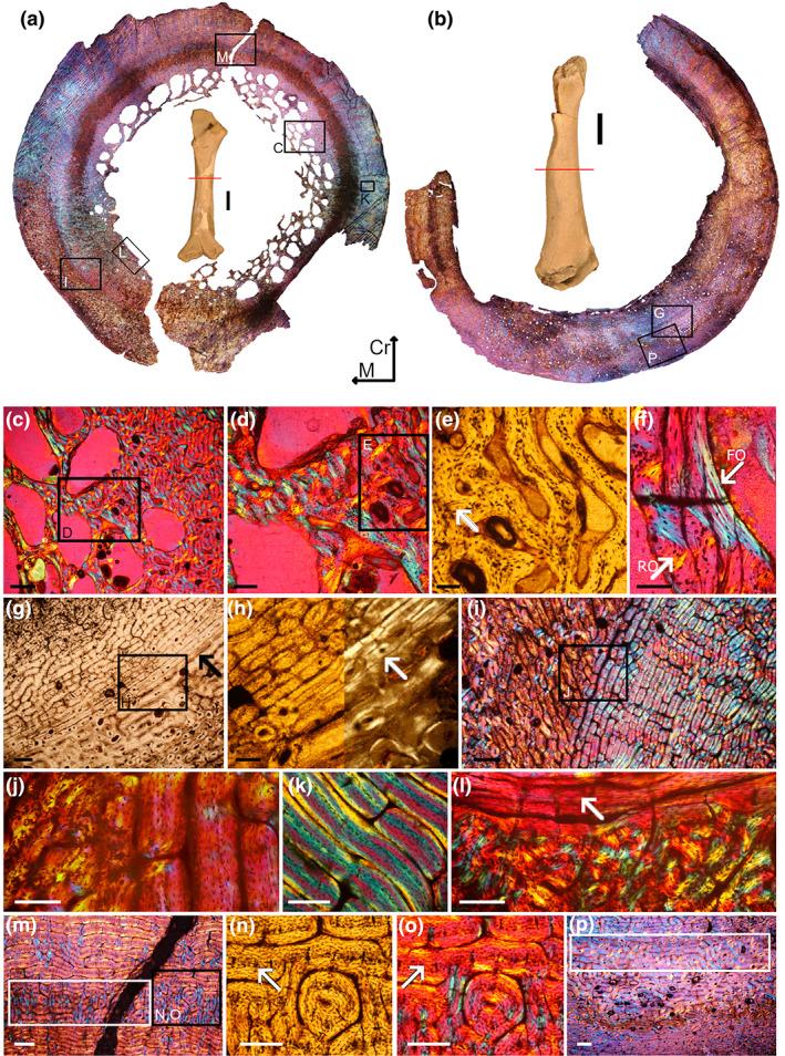https://cdn.ncbi.nlm.nih.gov/pmc/blobs/f210/10093165/88de3b456038/JOA-242-953-g008.jpg