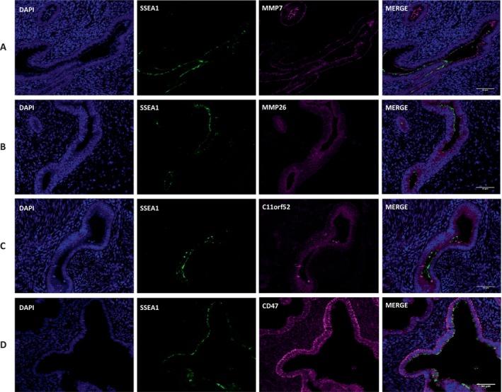 https://cdn.ncbi.nlm.nih.gov/pmc/blobs/f215/12038780/9bc9644bd885/FSB2-39-e70578-g004.jpg