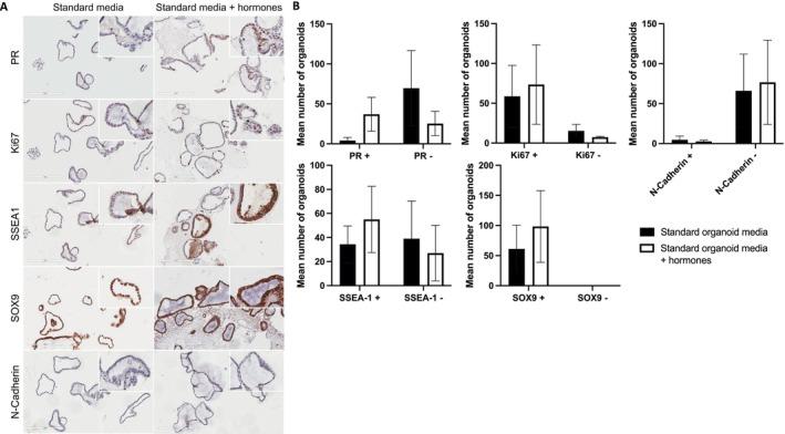 https://cdn.ncbi.nlm.nih.gov/pmc/blobs/f215/12038780/e61af4a83182/FSB2-39-e70578-g007.jpg