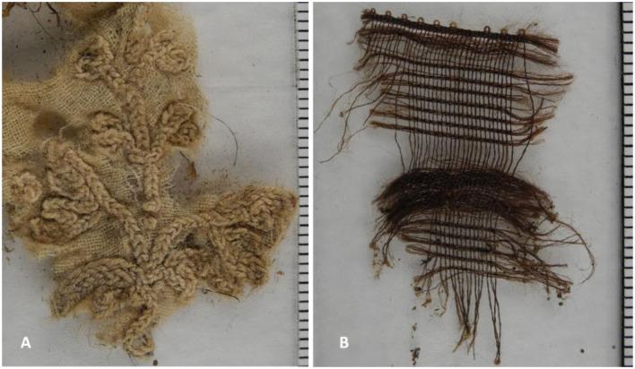https://cdn.ncbi.nlm.nih.gov/pmc/blobs/f218/12081436/7c98fe23dbca/fmed-12-1560050-g0014.jpg