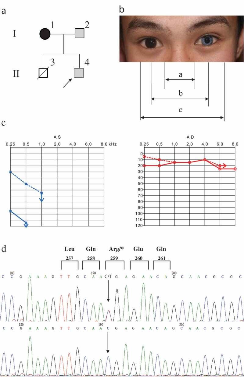 https://cdn.ncbi.nlm.nih.gov/pmc/blobs/f21a/6586136/e5e6c3ff314c/ZICH_A_1630219_F0001_OC.jpg