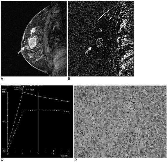 https://cdn.ncbi.nlm.nih.gov/pmc/blobs/f21d/2627175/296f63796d31/kjr-9-10-g002.jpg